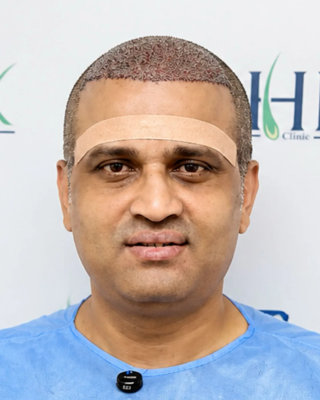 After treatment - Sachin Karande